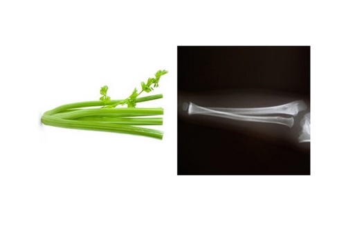 Foto - Bu yiyecekler benzedikleri organa iyi geliyor!