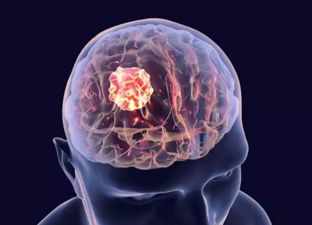 Foto - Bu yiyecekler beyin sağlığınızı mahvediyor