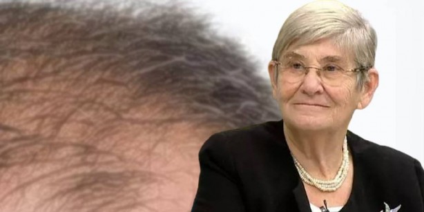 Foto - Bu yöntem, kepeği bıçak gibi kesiyor! Bunu deneyen, Canan Karatay’a sabah akşam dua edecek