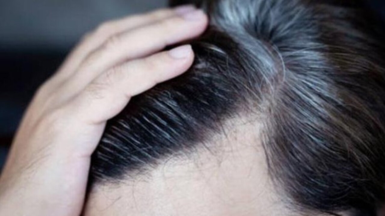 Foto - Bu yöntemi herkes bilmiyor! Beyaz saçları 30 dakikada yok ediyor