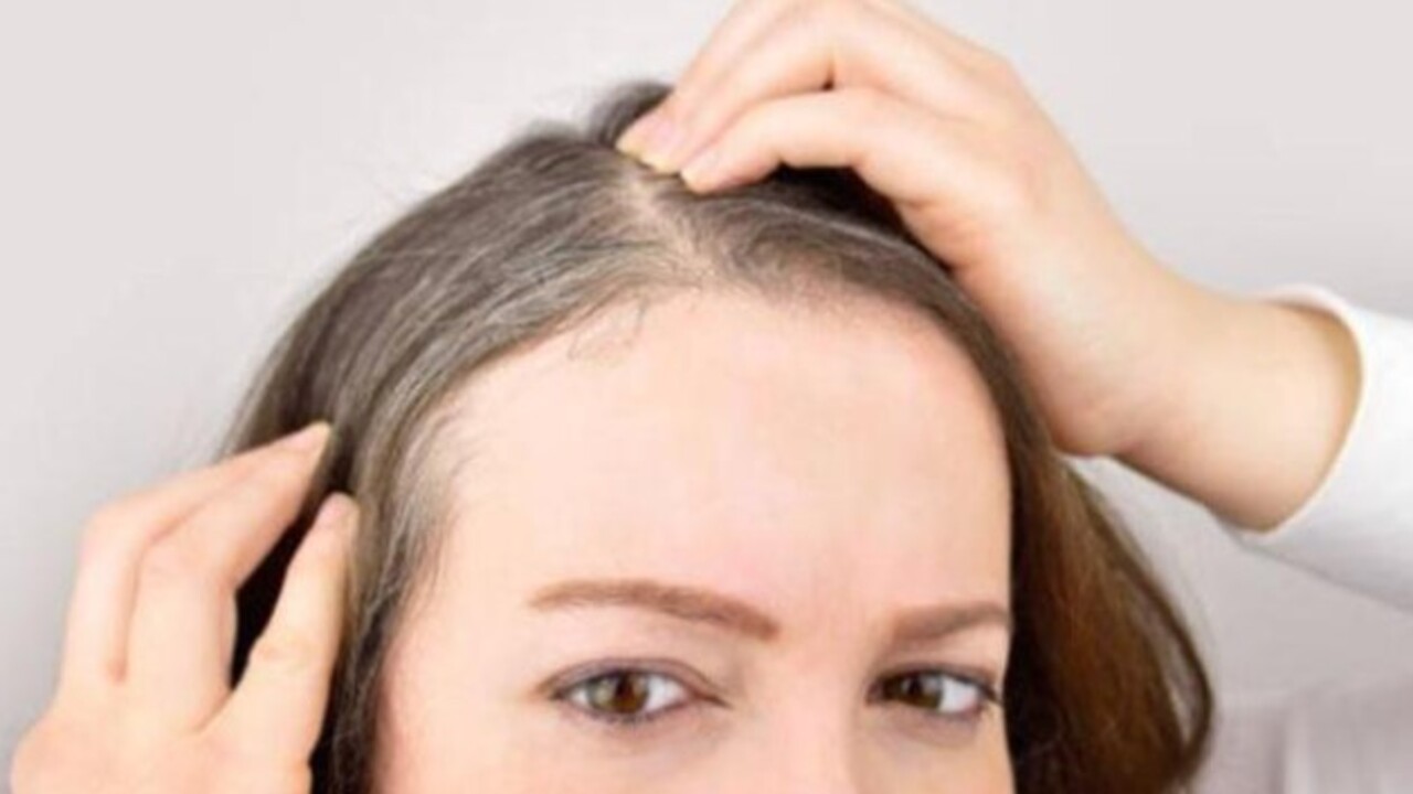 Foto - Bu yöntemi herkes bilmiyor! Beyaz saçları 30 dakikada yok ediyor