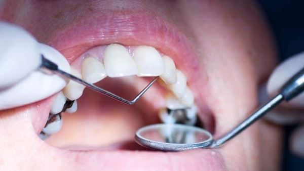 Foto - Bu zararları okuduktan sonra ağızdan nefes almayacaksınız!