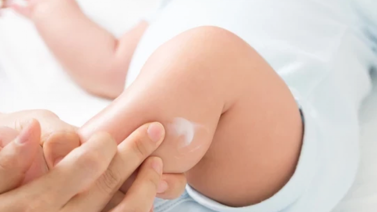 Foto - Bunlar evde mutlaka olsun! Ebeveynlerin acil durum için evde bulundurması gereken ilaçlar