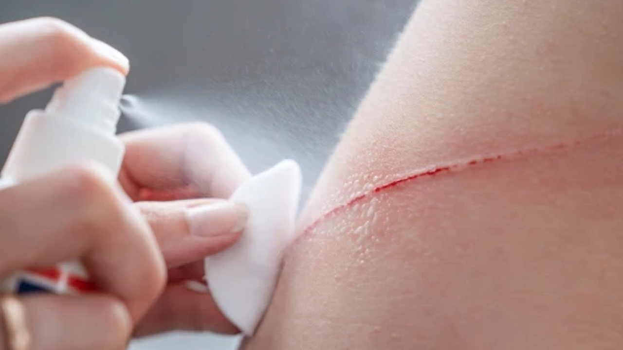 Foto - Bunlar evde mutlaka olsun! Ebeveynlerin acil durum için evde bulundurması gereken ilaçlar