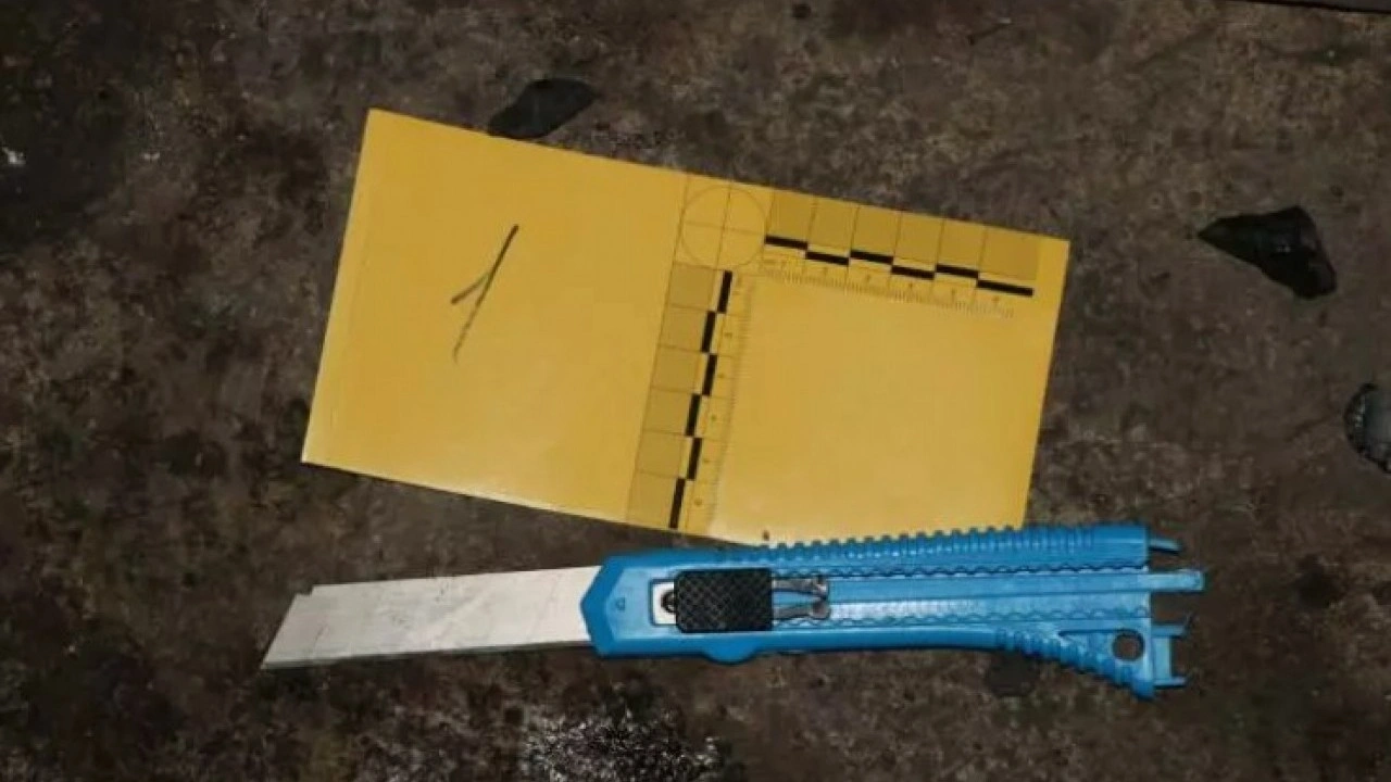 Foto - Bunlara idam gerek: 1,5 yaşındaki çocuğun boğazını kesti!