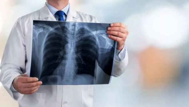 Foto - Bunları yaşayanlar dikkat! İşte akciğer kanserinin en yaygın 15 belirtisi...
