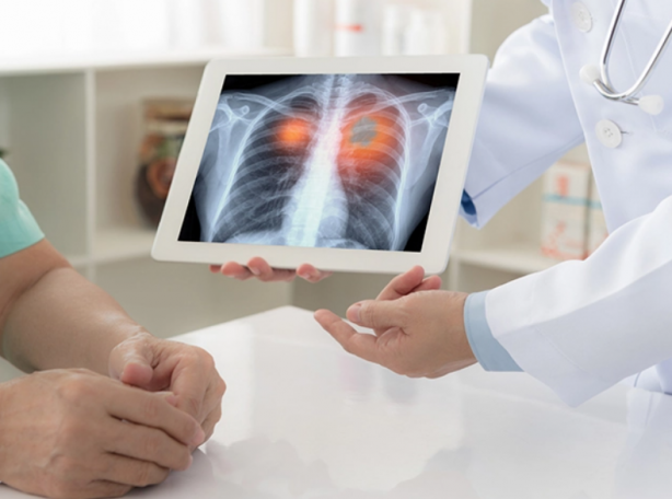 Foto - Bunları yaşayanlar dikkat! İşte akciğer kanserinin en yaygın 15 belirtisi...