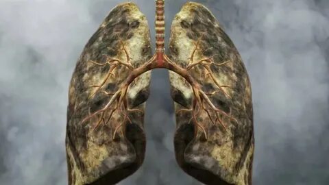 Foto - Bunları yiyen yaşadı! İşte akciğerleri temizleyen 6 besin