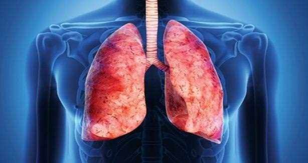 Bunları yiyen yaşadı! İşte akciğerleri temizleyen 6 besin