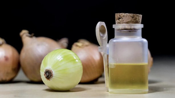 Foto - Bunu çok az kişi biliyor Soğan suyunu saçlara sürünce bakın ne oluyor