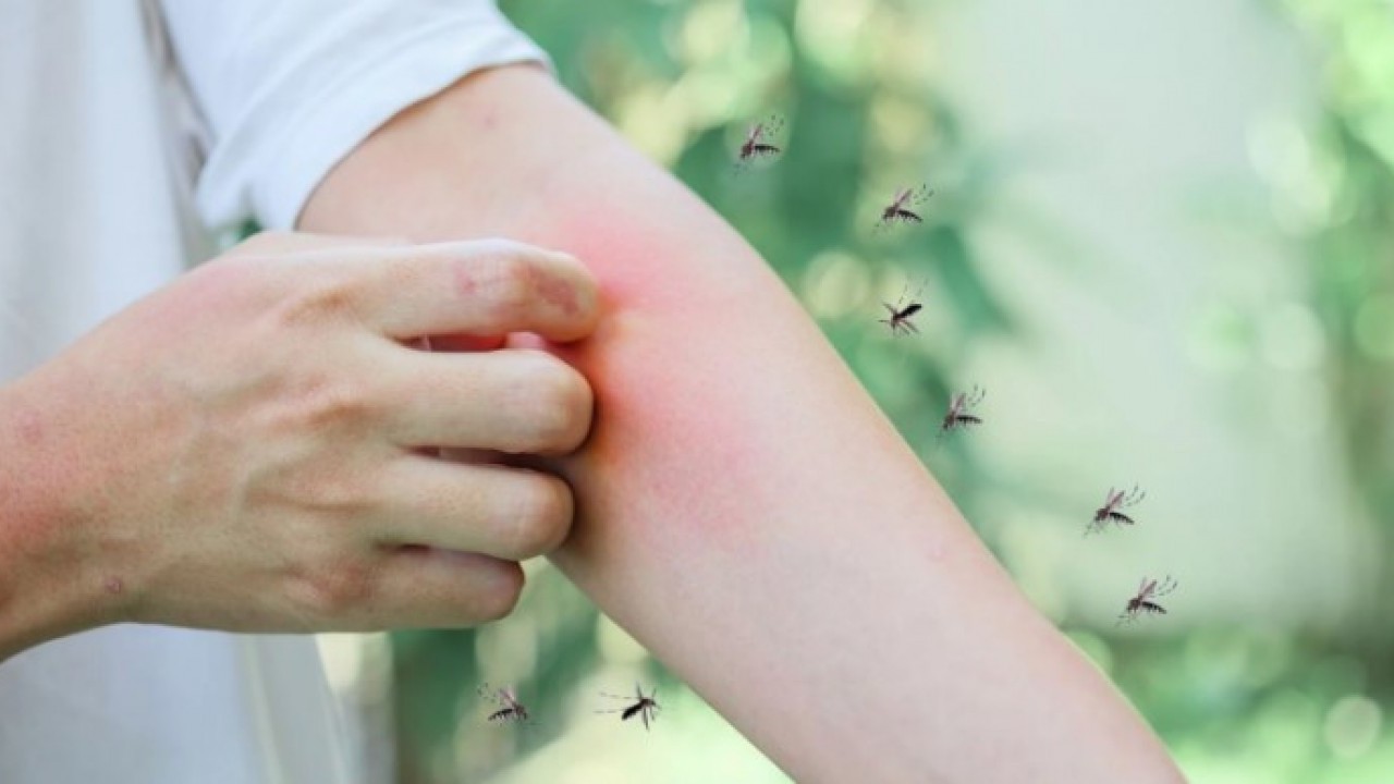 Foto - Bunu daha önce duymamış olabilirsiniz! Sivrisinekleri kökten bitiren çözüm