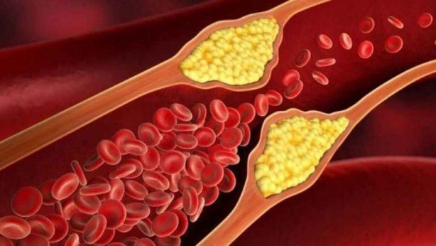 Foto - Bunu düzenli için: Yapan ilaçlara bir kuruş ödemiyor! Ne kilo ne kolestrol ne de şeker... Bu meyve ile veda etti