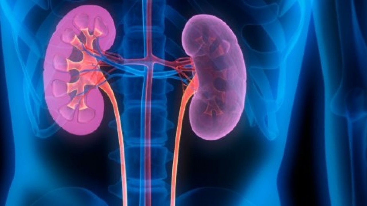 Foto - Bunu sakın yapmayın: Böbrekleri iflas ettiren hata!