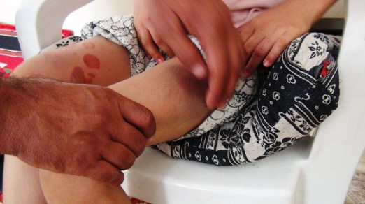 Foto - Bunun adı vahşet! 3 çocuğunu eve kapayıp kemer ve sopa ile...