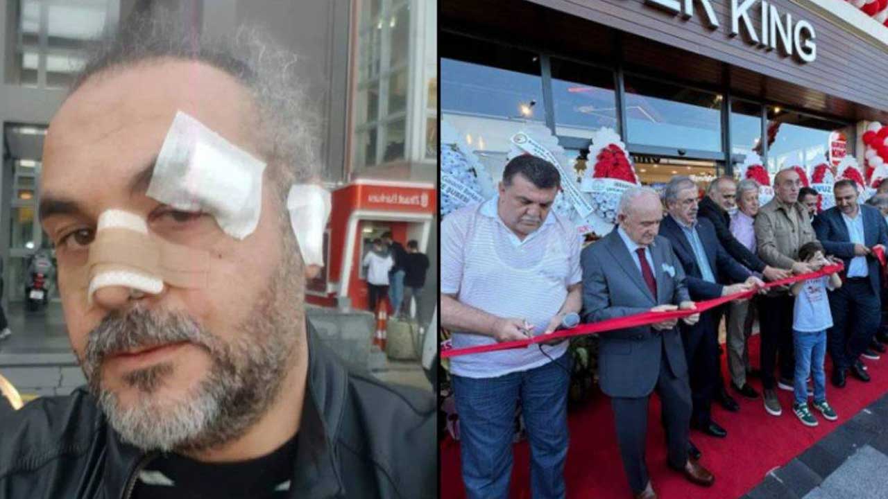 Foto - Burger King açılışına katılanları savunan ve eleştirenlere hakaret eden başkana AK Parti'den görev