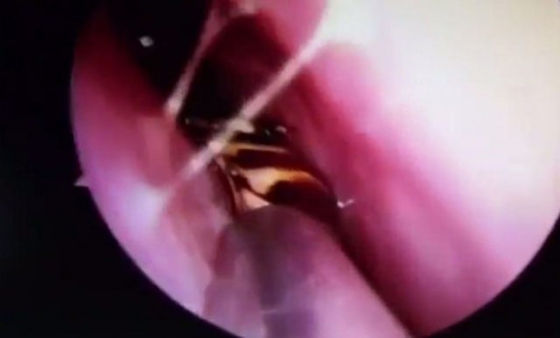 Foto - Burnu kaşınınca hastaneye gitti, hayatının şokunu yaşadı!