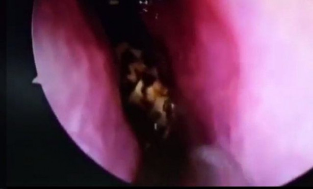 Foto - Burnu kaşınınca hastaneye gitti, hayatının şokunu yaşadı!