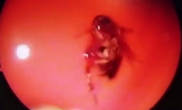 Foto - Burnu kaşınınca hastaneye gitti, hayatının şokunu yaşadı!