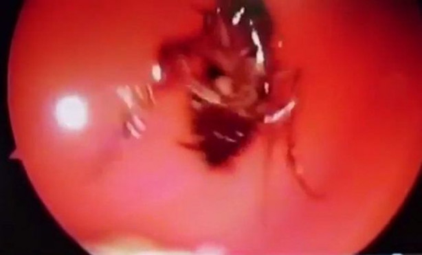 Foto - Burnu kaşınınca hastaneye gitti, hayatının şokunu yaşadı!