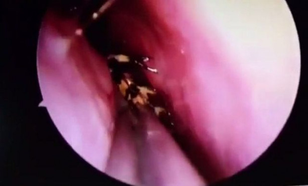 Foto - Burnu kaşınınca hastaneye gitti, hayatının şokunu yaşadı!