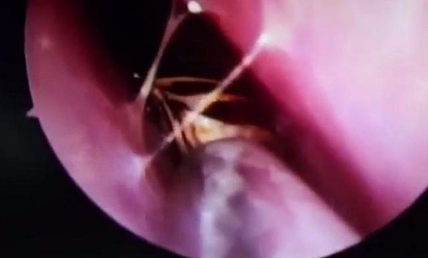 Foto - Burnu kaşınınca hastaneye gitti, hayatının şokunu yaşadı!