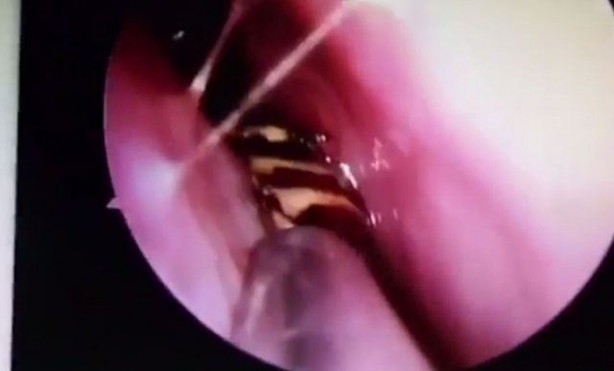 Foto - Burnu kaşınınca hastaneye gitti, hayatının şokunu yaşadı!