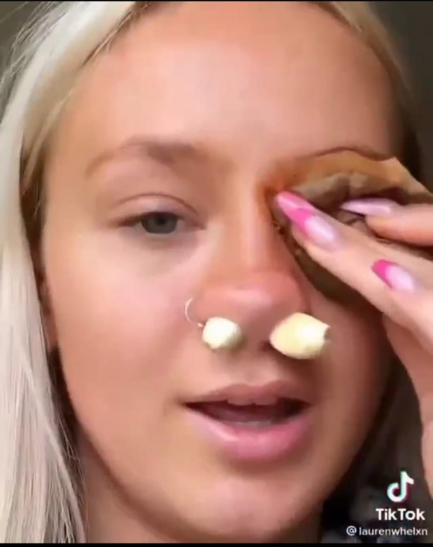 Foto - Burnunuza sarımsak sokup beklerseniz bakın oluyor! İnanılmaz görüntüler sosyal medyada infiale neden oldu