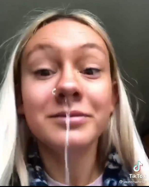 Foto - Burnunuza sarımsak sokup beklerseniz bakın oluyor! İnanılmaz görüntüler sosyal medyada infiale neden oldu