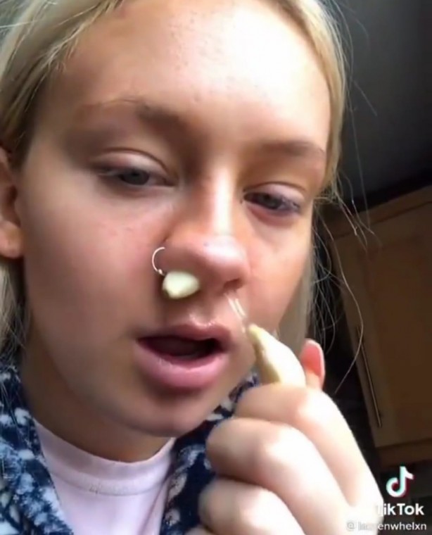 Foto - Burnunuza sarımsak sokup beklerseniz bakın oluyor! İnanılmaz görüntüler sosyal medyada infiale neden oldu