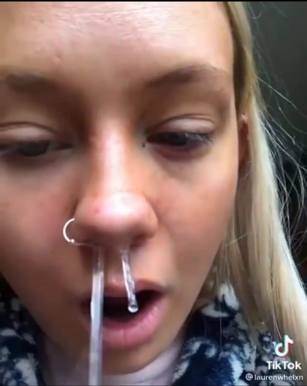 Foto - Burnunuza sarımsak sokup beklerseniz bakın oluyor! İnanılmaz görüntüler sosyal medyada infiale neden oldu