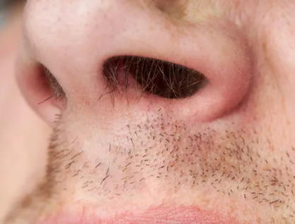 Burun kıllarına sakın dokunmayın! Keserseniz bakın ne oluyor