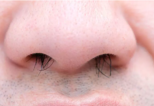 Foto - Burun kıllarına sakın dokunmayın! Keserseniz bakın ne oluyor