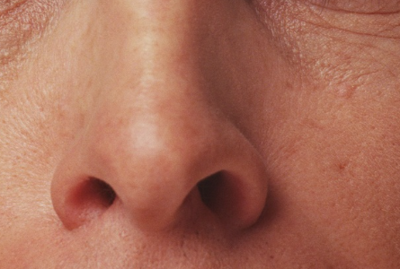 Foto - Burun kıllarına sakın dokunmayın! Keserseniz bakın ne oluyor