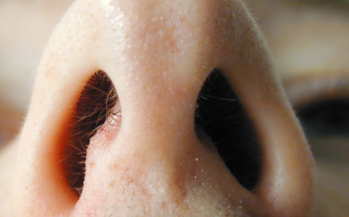 Foto - Burun kıllarına sakın dokunmayın! Keserseniz bakın ne oluyor