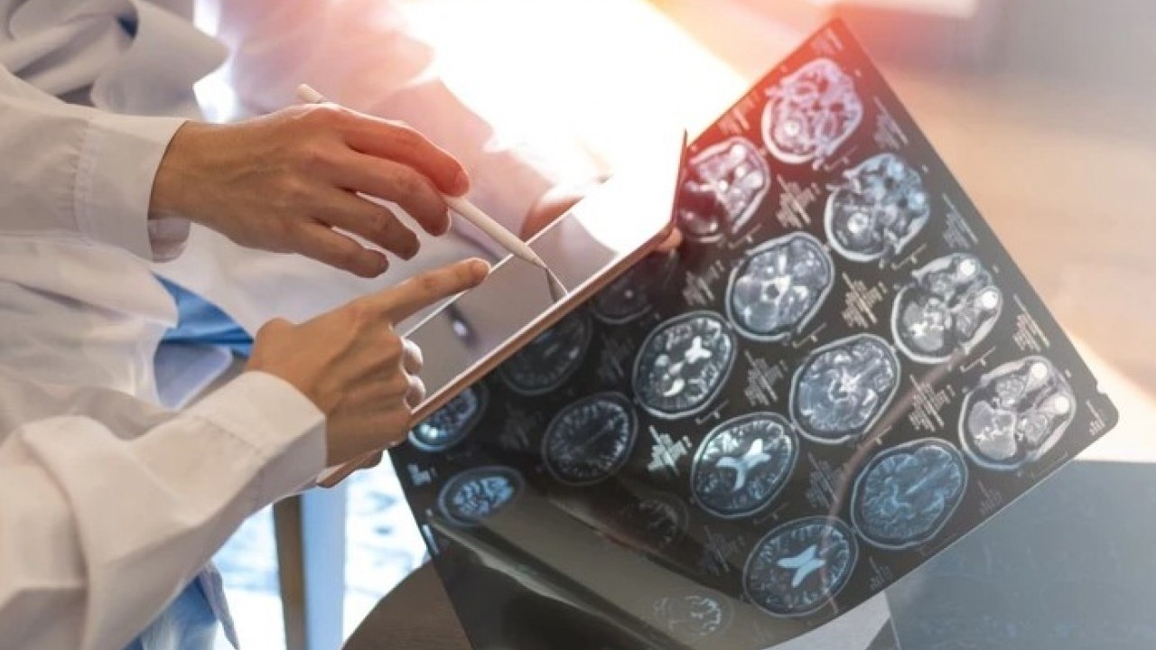 Foto - Büyük bir hastalığın habercisi olabilir! Ayaktayken öne eğik duranlar dikkat