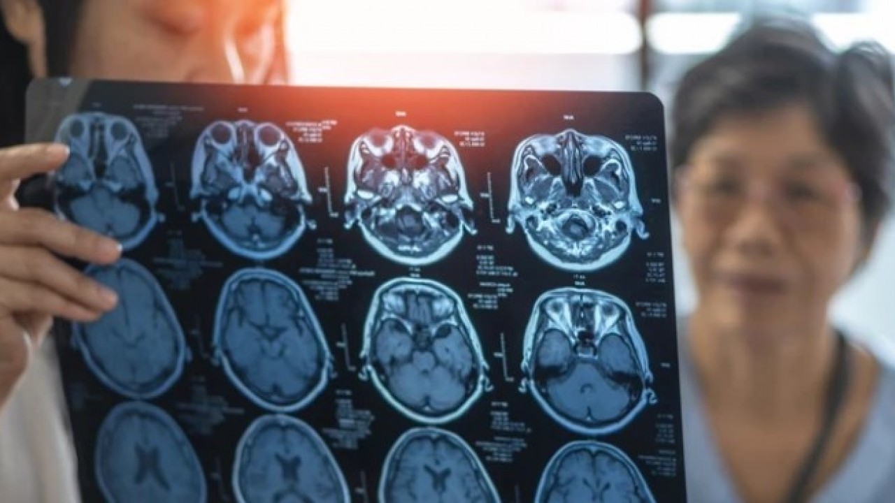 Foto - Büyük bir hastalığın habercisi olabilir! Ayaktayken öne eğik duranlar dikkat