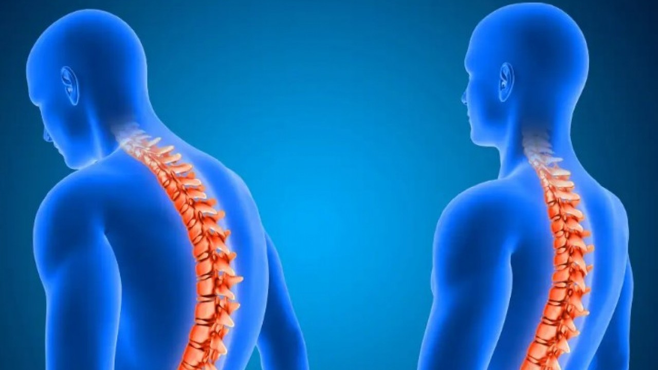 Büyük bir hastalığın habercisi olabilir! Ayaktayken öne eğik duranlar dikkat