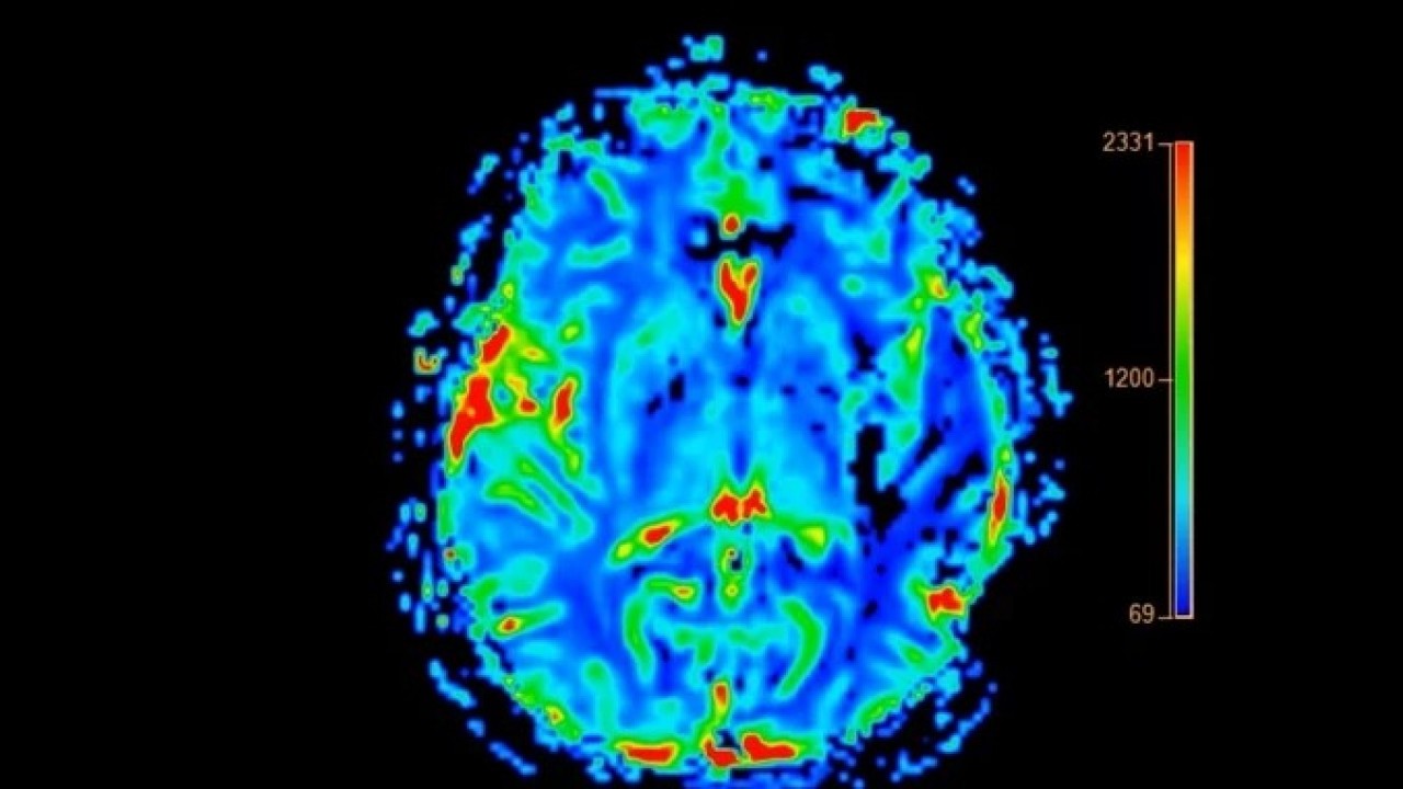 Foto - Büyük bir hastalığın habercisi olabilir! Ayaktayken öne eğik duranlar dikkat