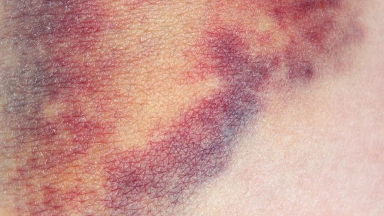 Foto - Büyük çöküş sebebi... Z kuşağı sıra sıra derilerini çürüttü: Buna niye gençler mecbur bırakılıyor