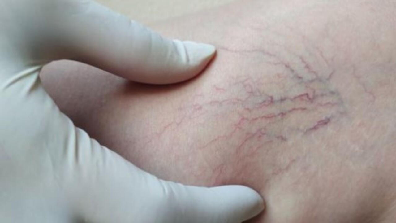 Foto - Büyük sağlık sorunlarına yol açıyor! Çok fazla ayakta duranlar dikkat