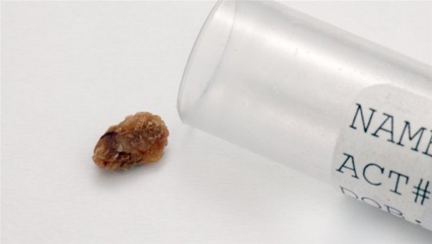 Büyük tehlike! Yavaşça ortaya çıkıyor, dayanılmaz ağrılar ve ölüm...