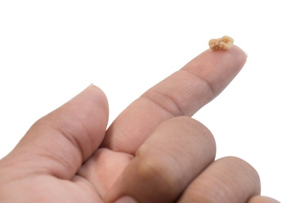 Foto - Büyük tehlike! Yavaşça ortaya çıkıyor, dayanılmaz ağrılar ve ölüm...