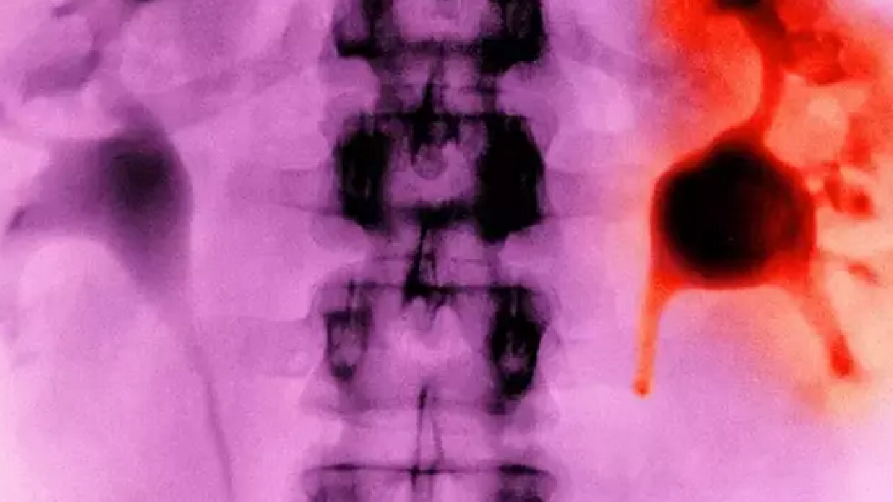 Foto - C vitamini, potasyum, malik asit, sitrik asit ve polifenol deposu! Böbreğin süpürgesi: Gilaburu ne işe yarar?