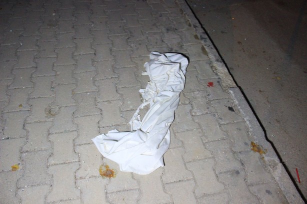 Foto - Çakmak tüpü bomba gibi patladı: 4 yaralı