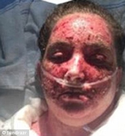 Foto - Çamaşır suyuyla yıkandı ve...