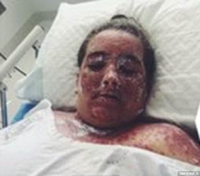 Foto - Çamaşır suyuyla yıkandı ve...