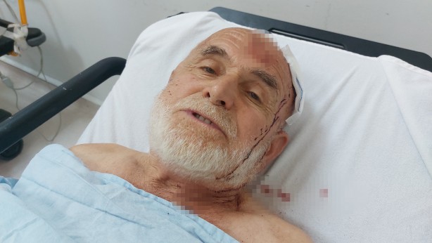 Foto - Cami çıkışı silahlı çatışma: 2 ölü, 7 yaralı