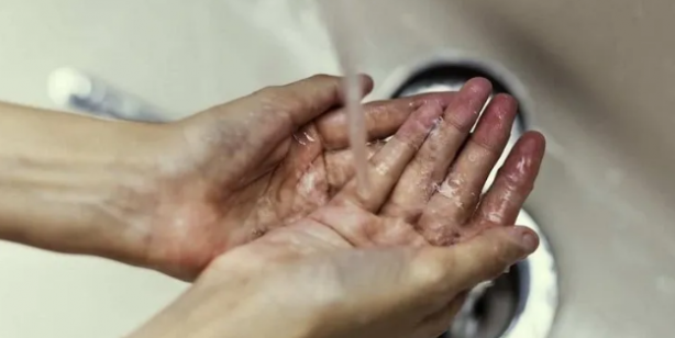 Foto - Canan Karatay 30 günde tüm sorunları giderecek yöntemi açıkladı: Kaşıntı, egzama, ürtiker, sedef bu sebeple ortaya çıkıyor!