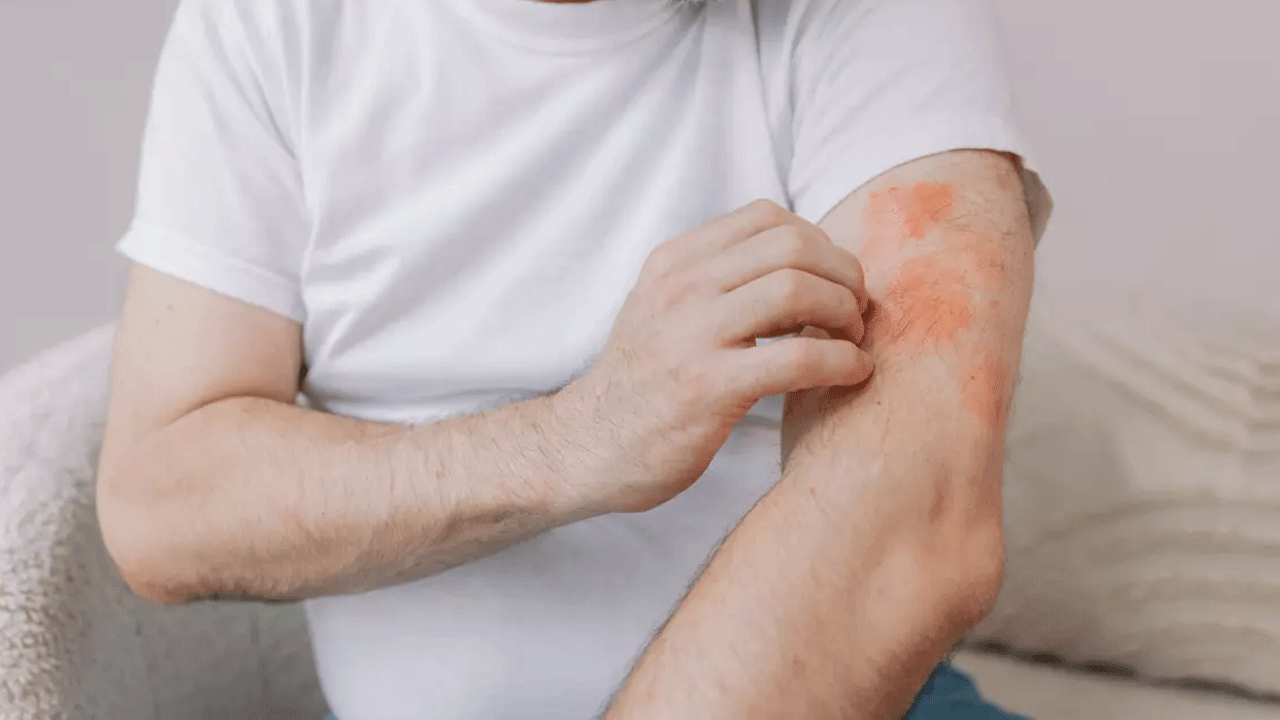 Foto - Canan Karatay'dan uyarı: Egzaması olan sakın bunu yapmasın!