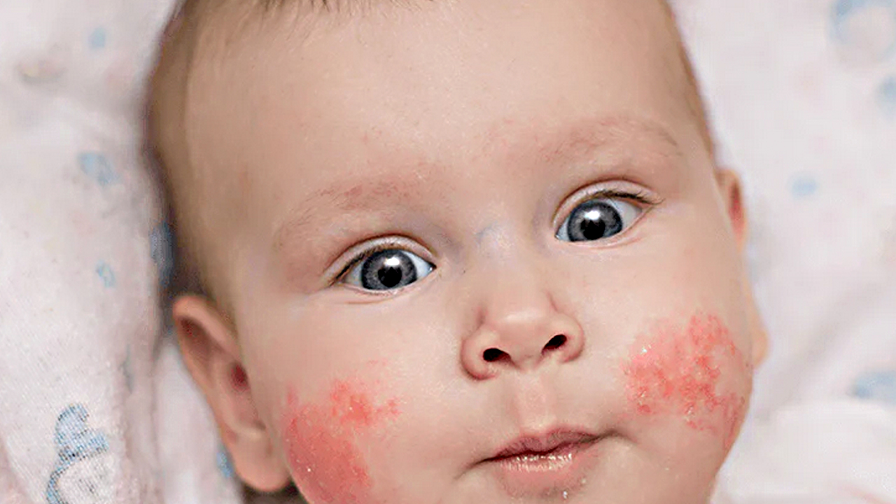 Foto - Canan Karatay'ın egzama uyarısı! Temizlikte çamaşır suyu mu sirke mi etkili? Bir ilk olacak açıklama…